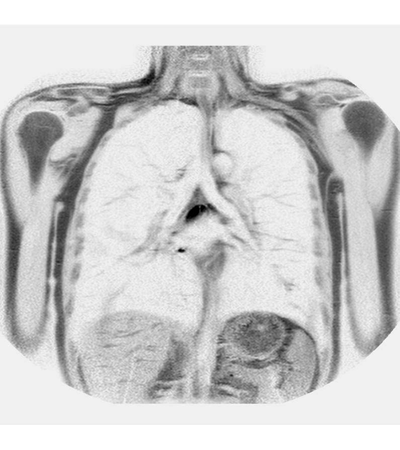 thorax