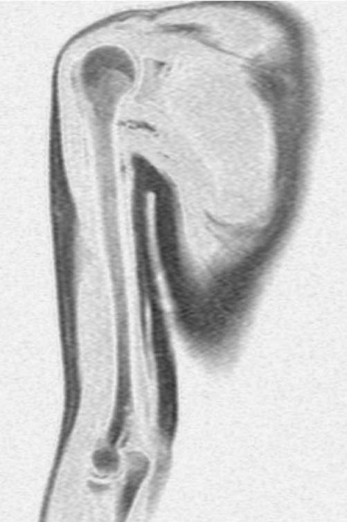 arm